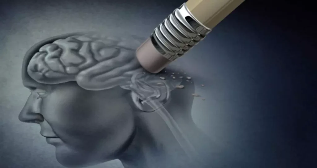 Aposentadoria por Alzheimer