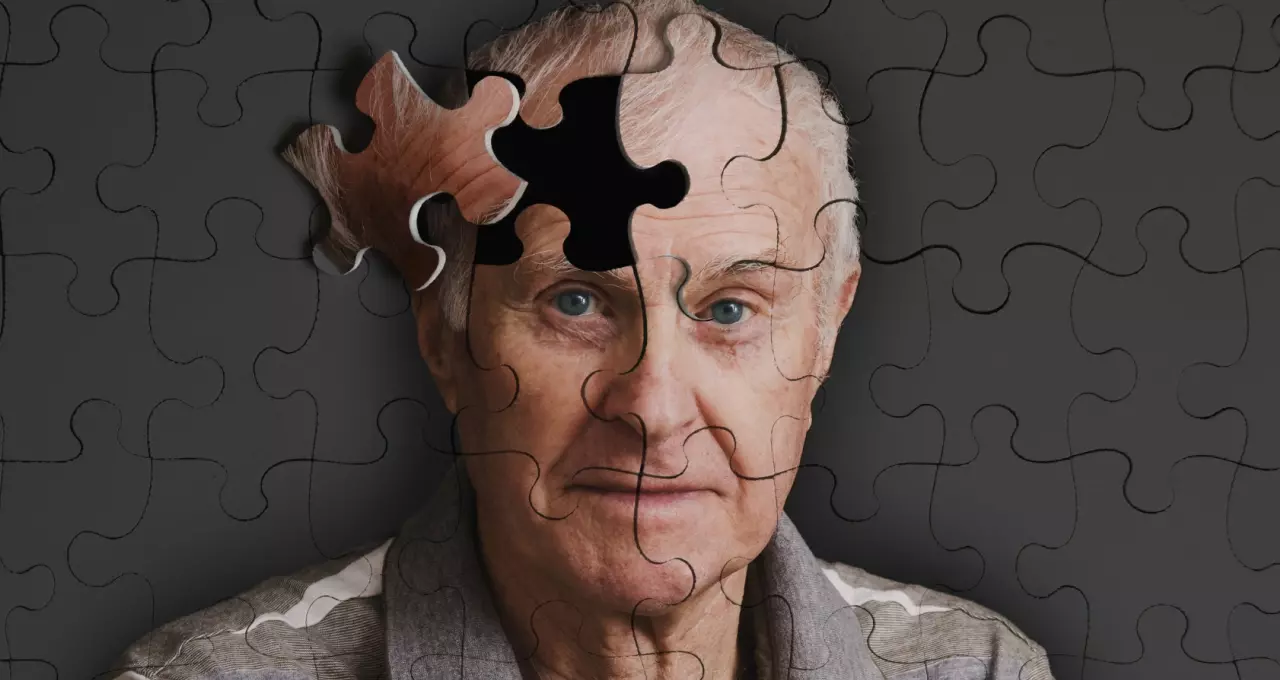 Aposentadoria por Alzheimer