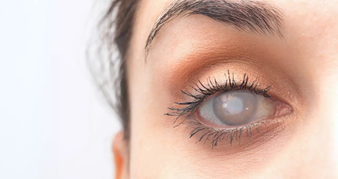 Aposentadoria por Cegueira Bilateral