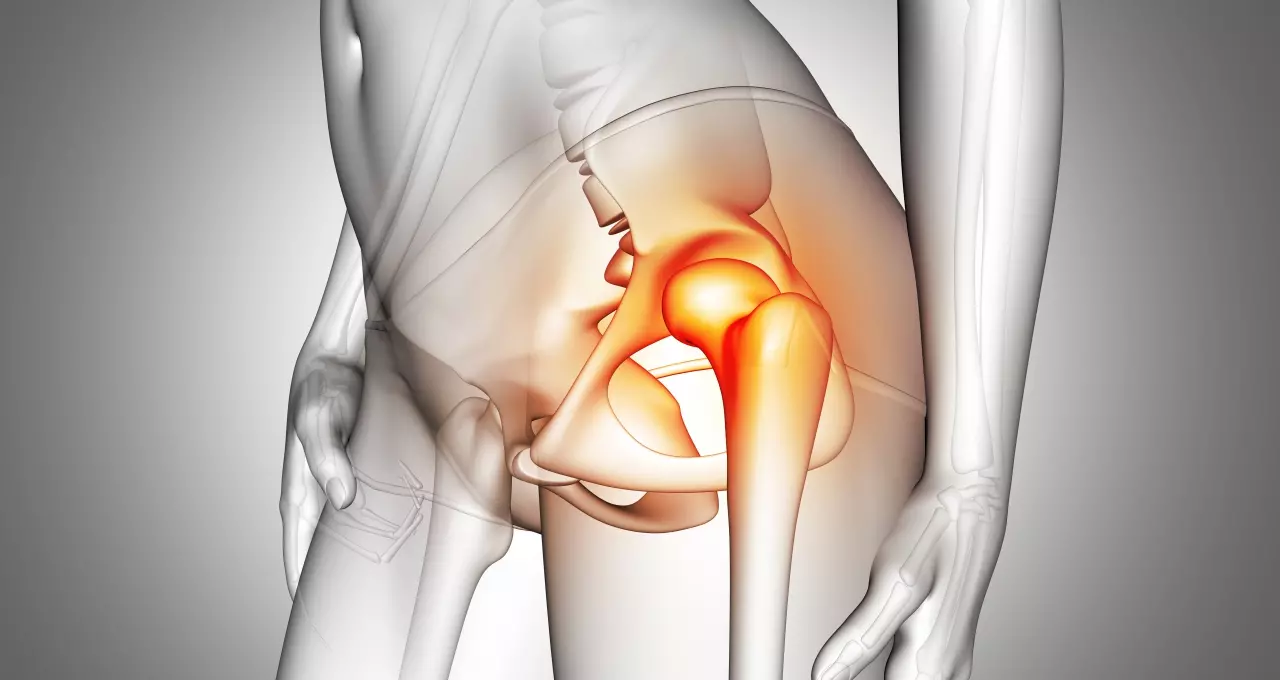 Aposentadoria por Doença de Paget