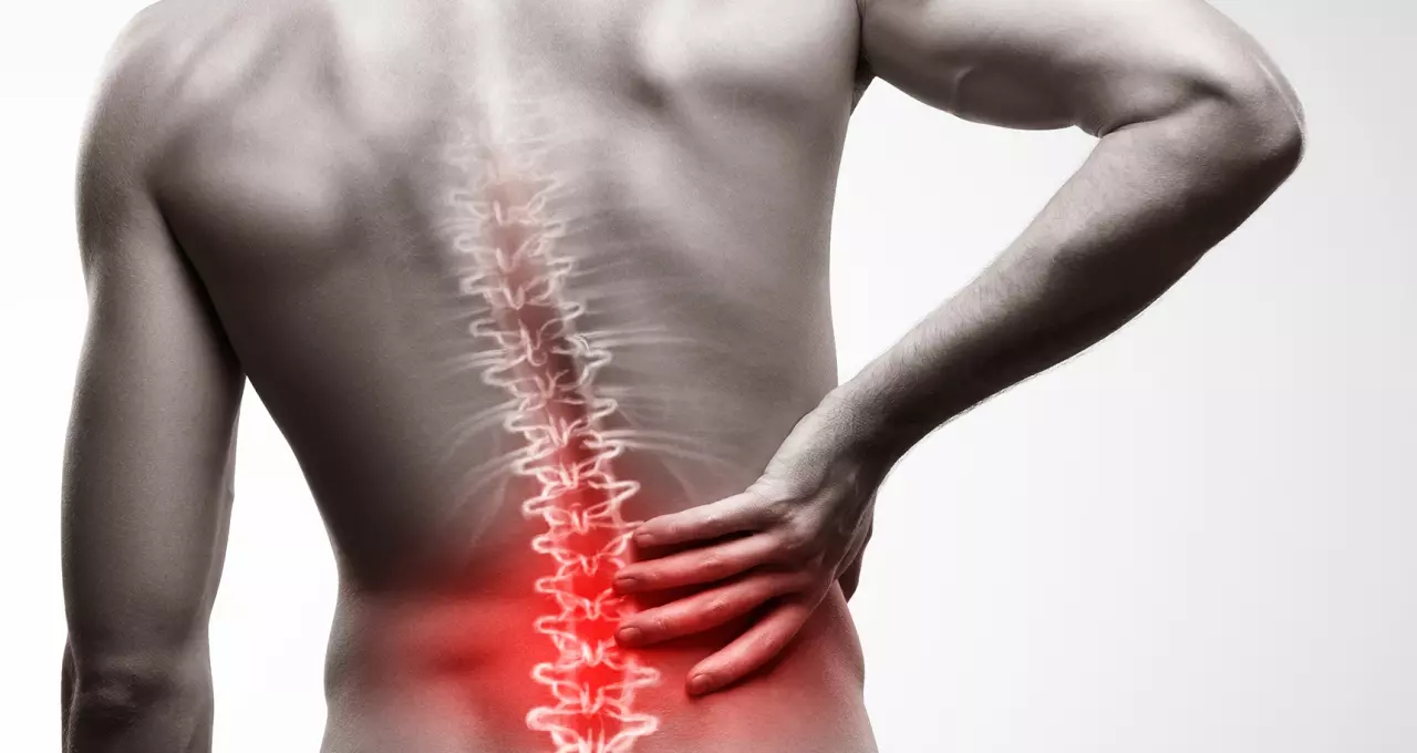 Aposentadoria por Espondiloartrose Anquilosante